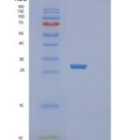 人TACO1重组蛋白