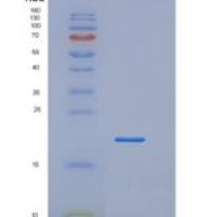 人肿瘤坏死因子β(TNFb)重组蛋白