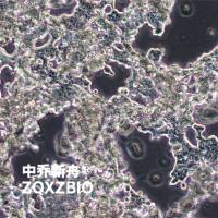 NCI-H526人小细胞肺癌细胞