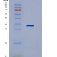 人转铁蛋白受体(TFR)重组蛋白