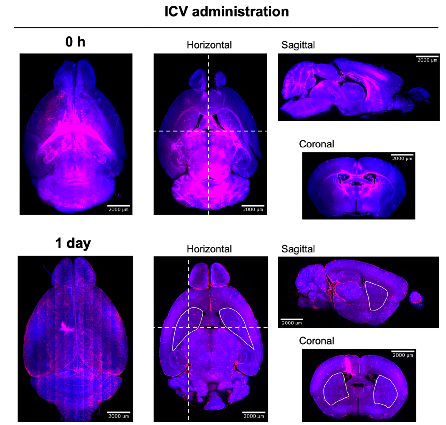 《Bioconjugate Chemistry》：组织透明化三维成像揭示小分子外用药物NA在脑内分布