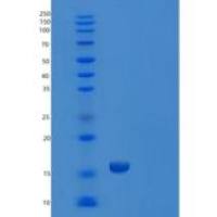 人推定的TGFB1诱导的抗凋亡因子1（TIA f1）重组蛋白