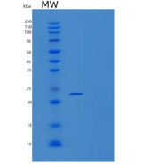 人组织金属蛋白酶抑制因子4(TIMP4)重组蛋白
