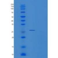 人组织金属蛋白酶抑制因子2(TIMP2)重组蛋白