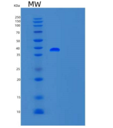 人TFB1M重组蛋白