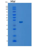 人TARDBP重组蛋白
