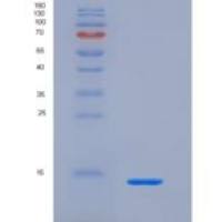 人三叶因子1(TFF1)重组蛋白