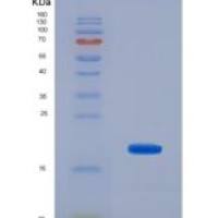 人微管蛋白折叠辅酶A(TBCA)重组蛋白