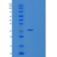 人THTPA重组蛋白