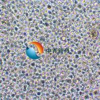 OPM-2 人多发性骨髓瘤细胞