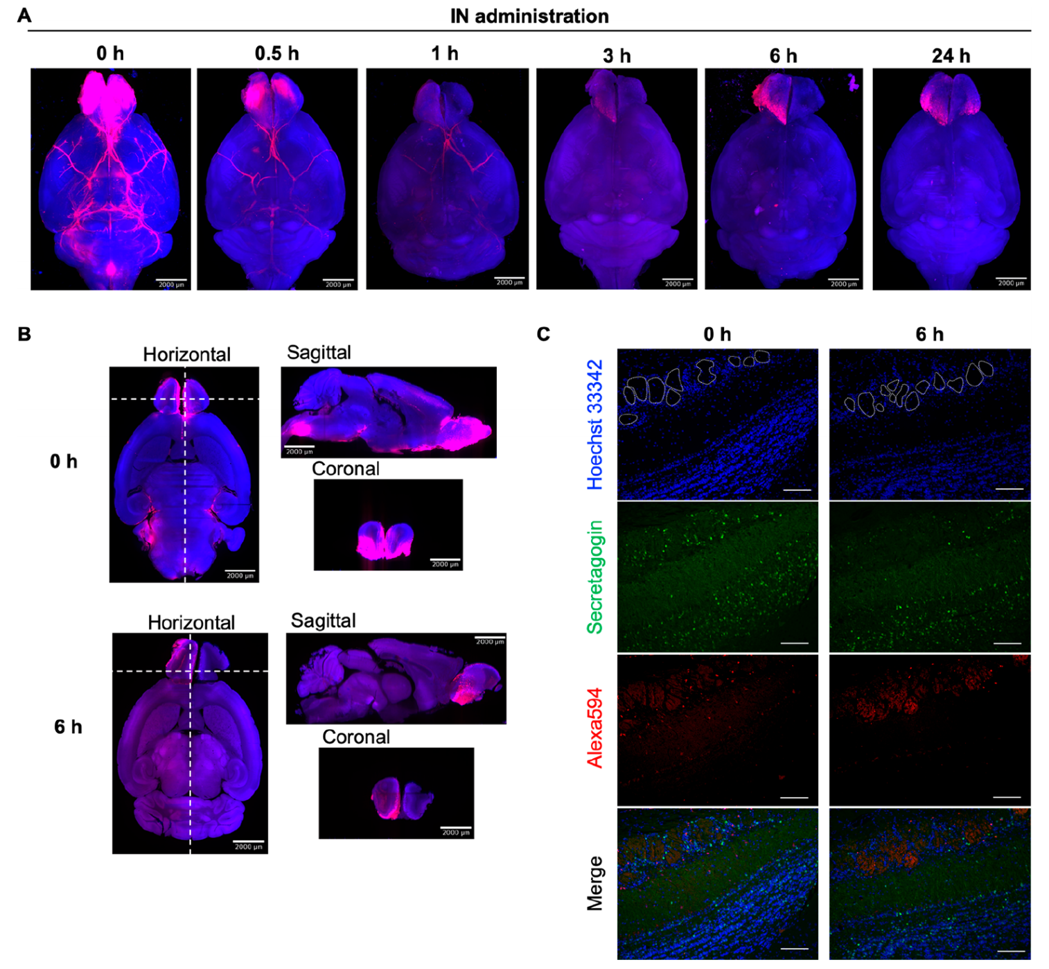 《Bioconjugate Chemistry》：组织透明化三维成像揭示小分子外用药物NA在脑内分布