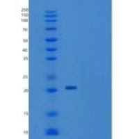 人核因子κB受体激活因子配体(RANkL)重组蛋白