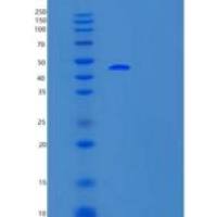 人TFB2M重组蛋白