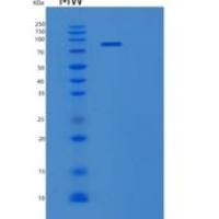 人谷氨酰胺转胺酶2(TGM2)重组蛋白