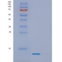 人γ-突触核蛋白重组蛋白