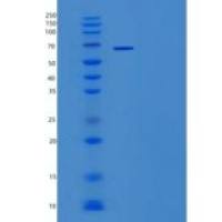 人Toll样受体2(TLR2)重组蛋白