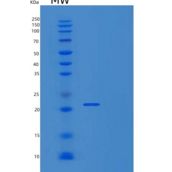 人TATA框结合蛋白关联因子9(TAF9)重组蛋白