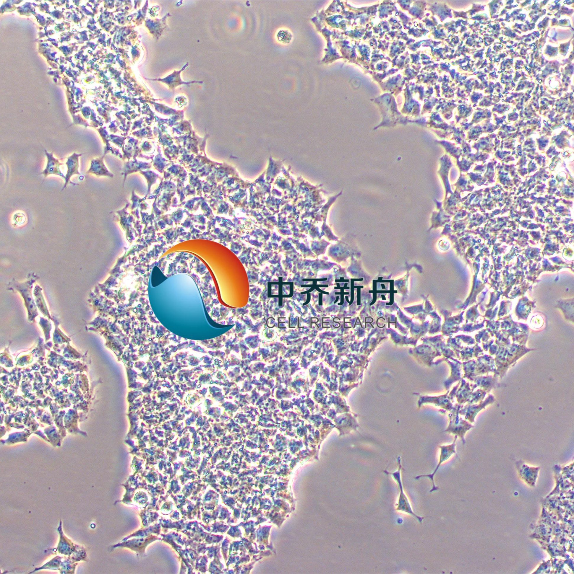 RD-ES 人尤文氏肉瘤