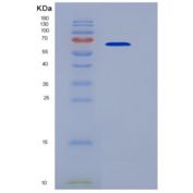 人肿瘤坏死因子受体超家族成员10C(TNFRSF10C)重组蛋白