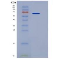 人肿瘤坏死因子受体超家族成员10C(TNFRSF10C)重组蛋白