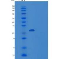人THO复合体亚基7(THOC7)重组蛋白