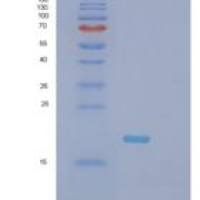 小鼠肿瘤坏死因子α(TNFa)重组蛋白