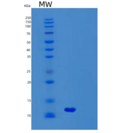 人联会复合体中心元件蛋白3（syc 3）重组蛋白