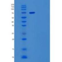 人转酮醇酶(TKT)重组蛋白