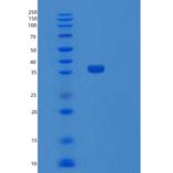 人SULT1C4 1-302aa重组蛋白