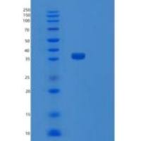 人SULT1C4 1-302aa重组蛋白