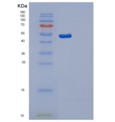 人突触囊泡蛋白Ⅺ(SYT11)重组蛋白