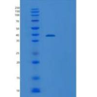 人转醛缩酶(TALDO1)重组蛋白