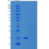 小鼠转化生长因子β1(TGFb1)重组蛋白