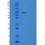 人TBC1域家族成员13(TBC1D13)重组蛋白