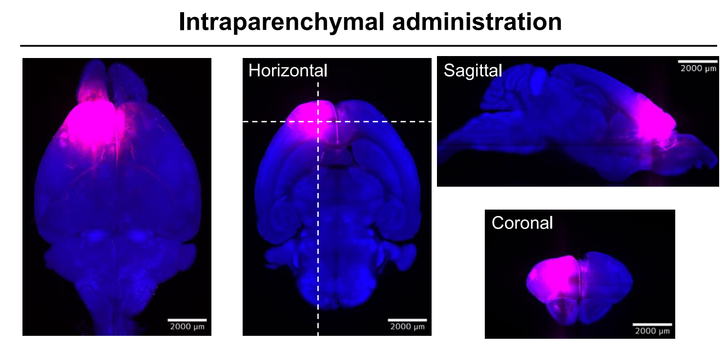 《Bioconjugate Chemistry》：组织透明化三维成像揭示小分子外用药物NA在脑内分布