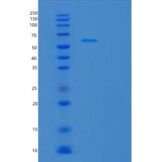 人TBC1D22B重组蛋白