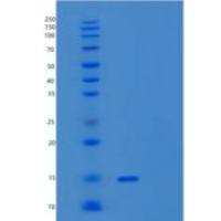 人α-突触核蛋白A53T重组蛋白