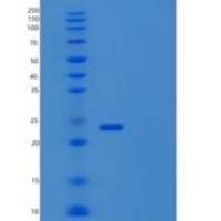 人TGIF2LY重组蛋白