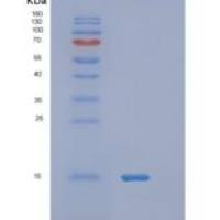 人速激肽1(TAC1)重组蛋白