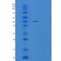 人磺基转移酶2B1(SULT2B1)重组蛋白