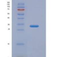 人肿瘤关联钙信号转导子2(TACSTD2)重组蛋白