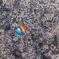 NCI-H1581人非小细胞肺癌细胞