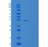人重组人BCL6 / B细胞CLL淋巴瘤6蛋白（aa 1-150）重组蛋白
