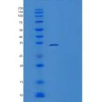 人重组人BCL6 / B细胞CLL淋巴瘤6蛋白（aa 1-150）重组蛋白