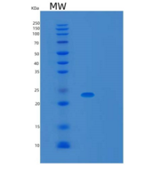 人TBPL1重组蛋白