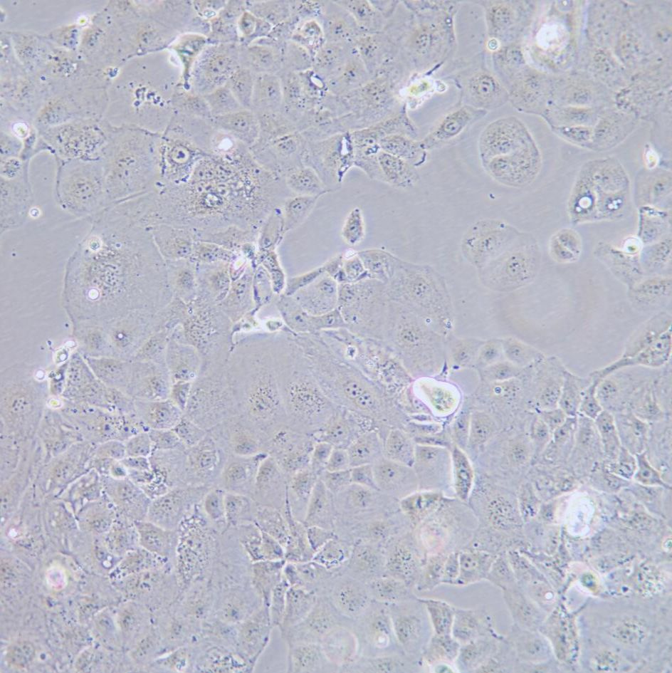 PLC/PRF/5 人肝癌亚力山大细胞/STR鉴定/镜像绮点（Cellverse）