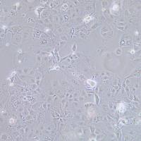 PLC/PRF/5 人肝癌亚力山大细胞/STR鉴定/镜像绮点(Cellverse)