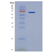 人肿瘤坏死因子受体超家族成员10C(TNFRSF10C)重组