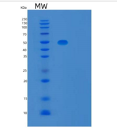人TBCEL重组蛋白