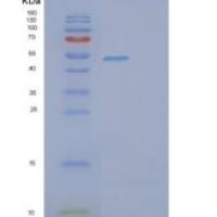 人亚硫酸盐氧化酶(SUOX)重组蛋白